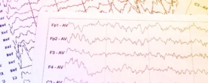 Electrophysiology