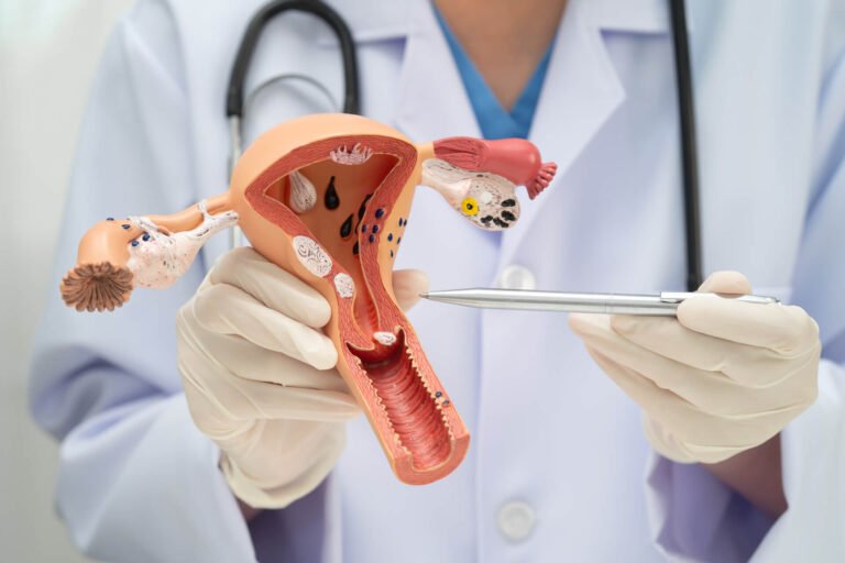 Fibroid in the Uterus