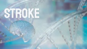 Stroke tratment in thane