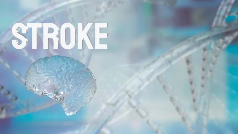 Stroke tratment in thane