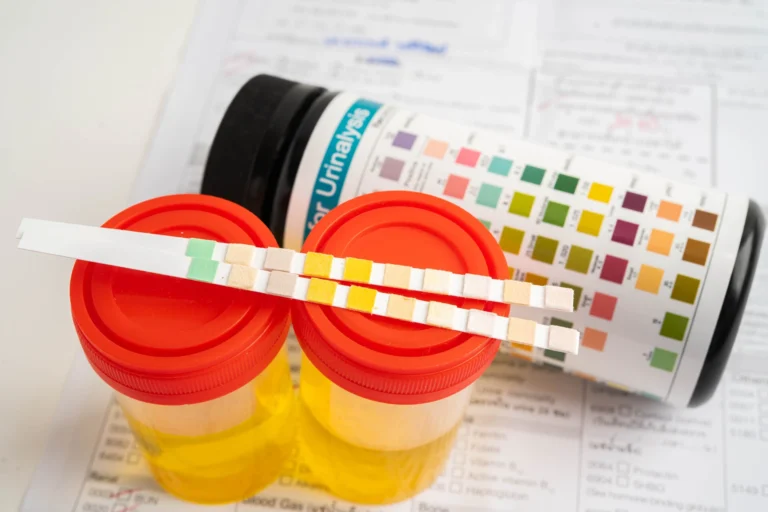 Urinary Tract Infection