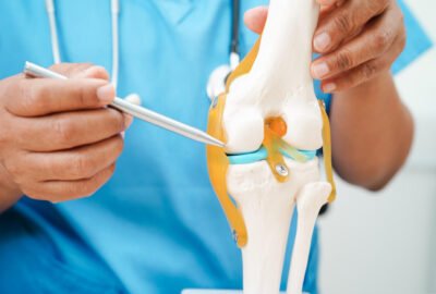 Diagram of a knee joint with a metal and plastic knee replacement implant
