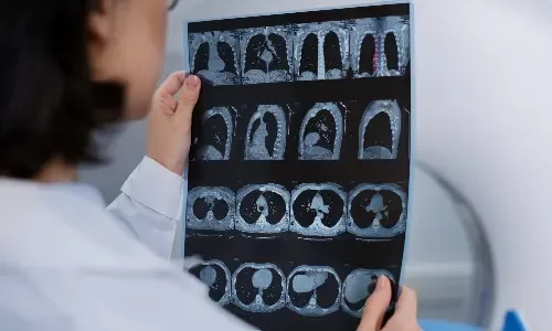 CT Angiography in Thane