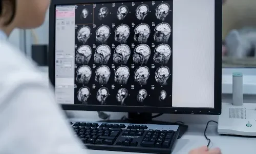 CT Brain Scan in Thane