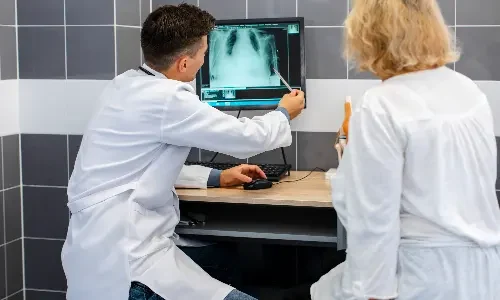 CT Chest Scan in Thane