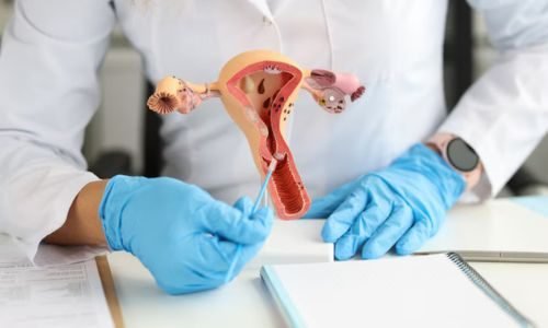 Gynecological Services