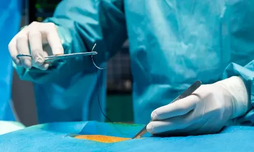 Single-Incision Laparoscopic Surgery (SILS)